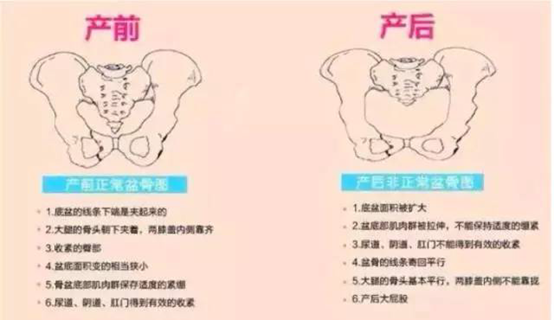 产后修复